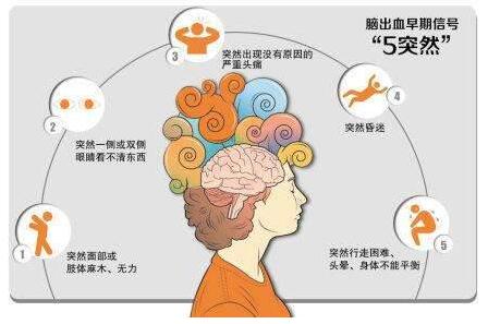 心腦血管病別等發(fā)作才篩查，經(jīng)顱多普勒TCD超聲檢測(cè)心腦血管